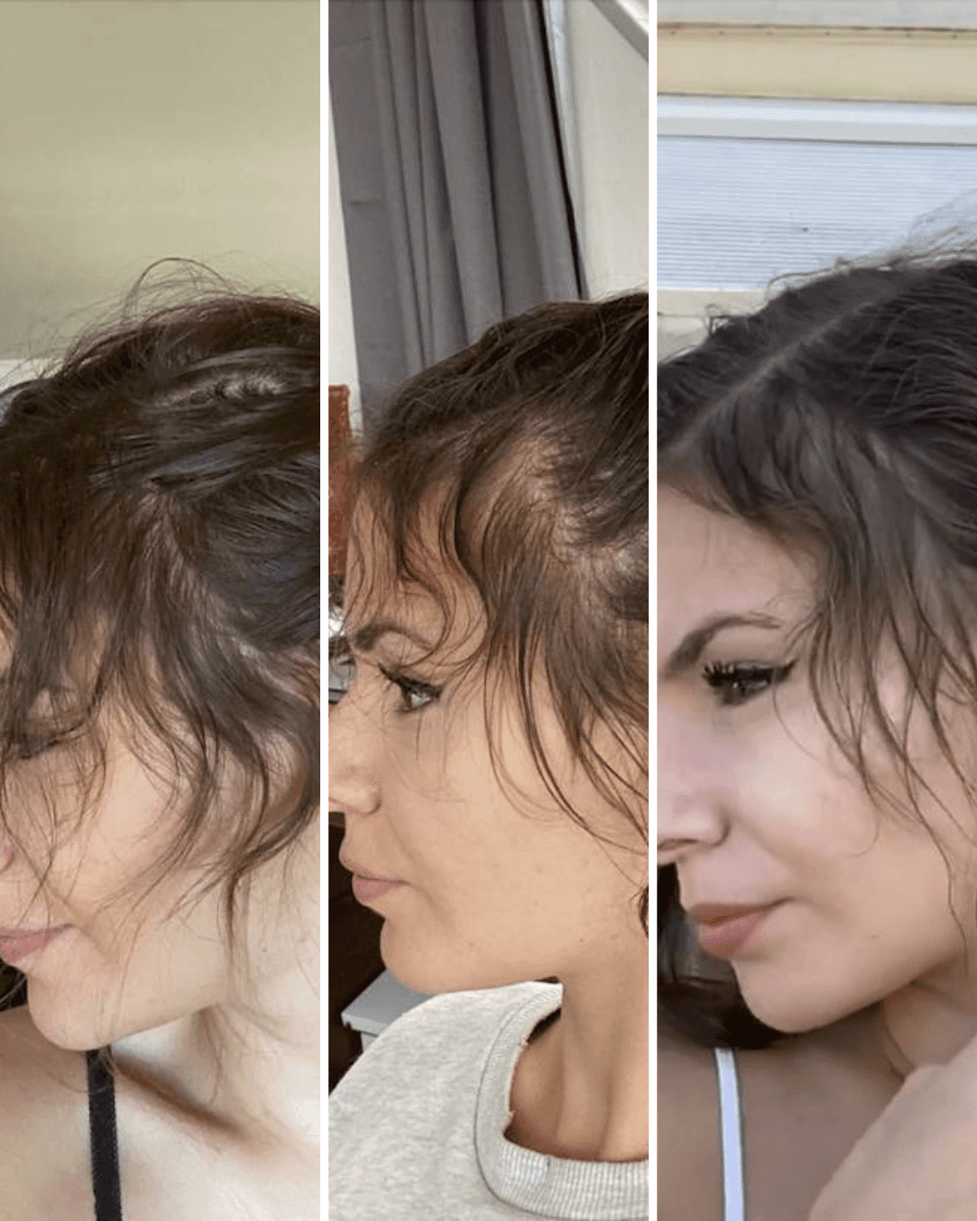 Pourquoi mes cheveux ont cassé à quelques centimètres de la racine ?